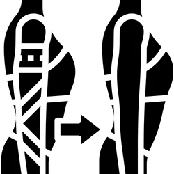 Joint Replacement Surgery